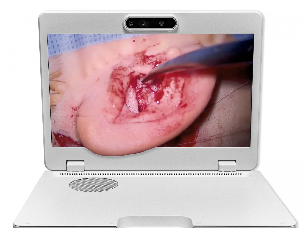 达擎之＂Heads-up 3D显微手术显示系统＂，整合4K裸眼3D显示及眼球追踪系统，具备快速追踪人眼移动位置功能，减轻医师长时间维持固定姿势的负担，让医师能有更宽广清晰的3D立体视野及更舒适的姿势来执行手术。